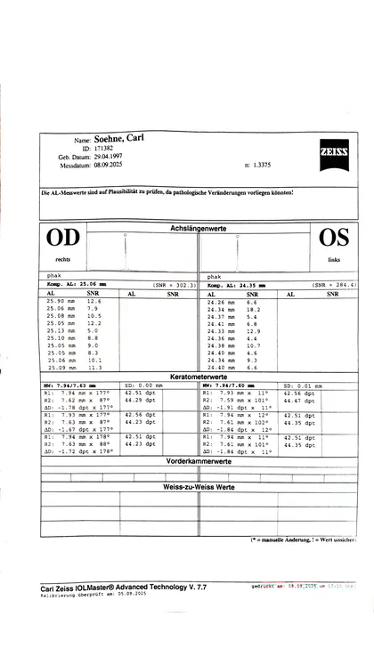 Gescannter IOLMaster-Ausdruck vom 08.09.2025: rechtes Auge 25.06 mm, linkes Auge 24.35 mm