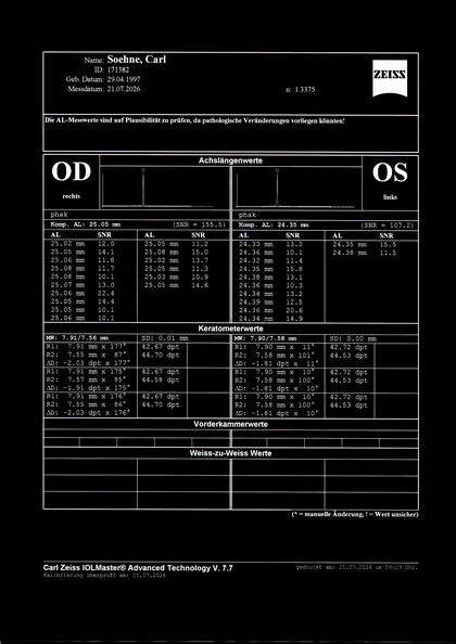 Gescannter IOLMaster-Ausdruck vom 21.07.2026: rechtes Auge 25.05 mm, linkes Auge 24.35 mm (Hochkontrast-Fassung)